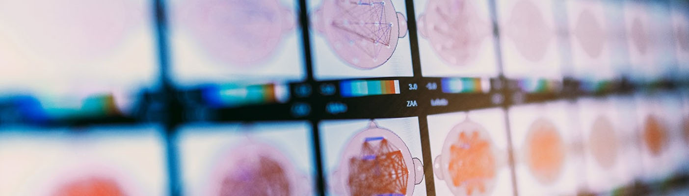 比爾·蓋茨 | AI新紀元-第二次革命性時刻已經來臨(圖4) AI_20230215_article-hero2.jpg